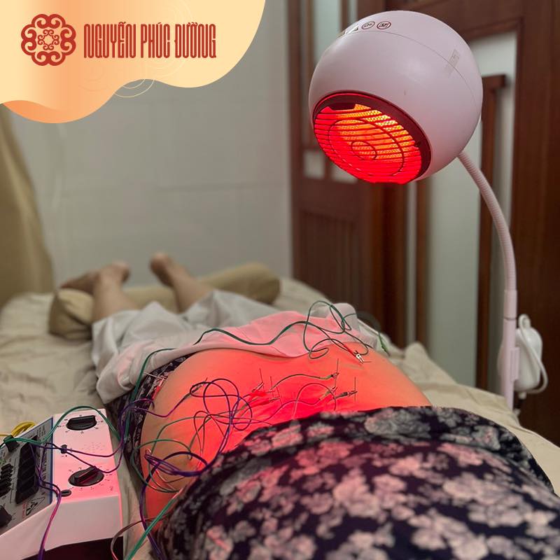 Đau thần kinh tọa nhiều năm
