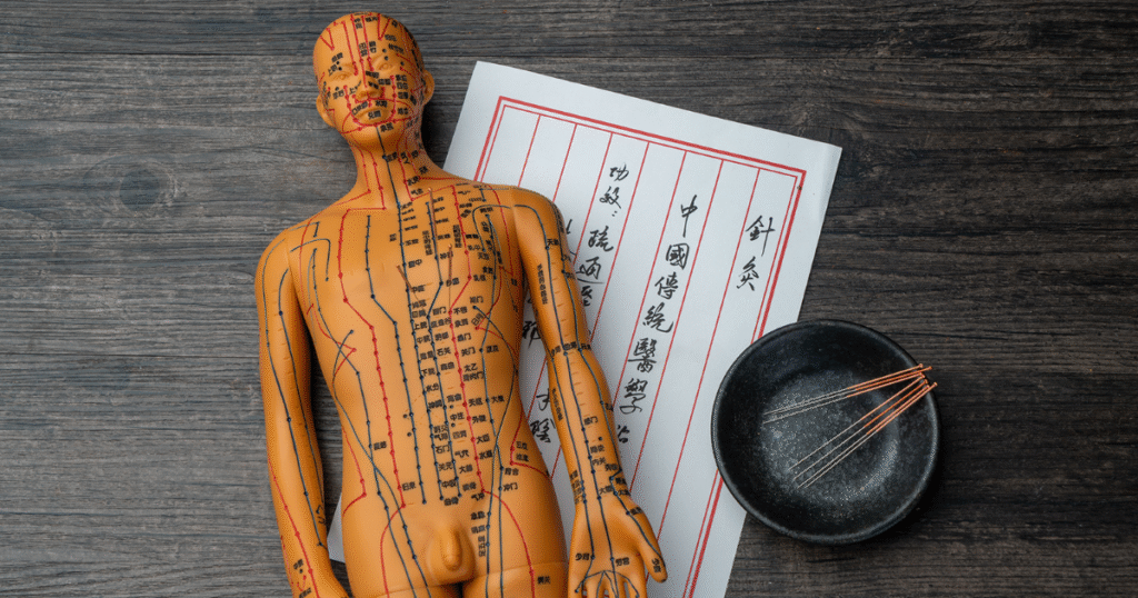 Kết hợp thuốc thảo dược và châm cứu trong điều trị mất ngủ